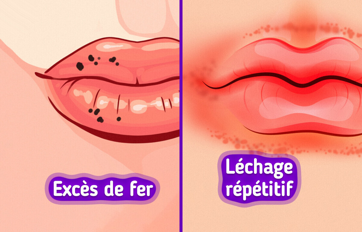 8 Choses que tes lèvres essaient de dire sur ta santé 8 Choses que tes lèvres essaient de dire sur ta santé