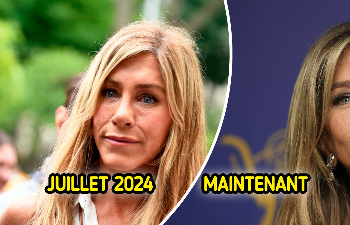 Jennifer Aniston surprend ses fans en renonçant aux produits de comblement Jennifer Aniston surprend ses fans en renonçant aux produits de comblement