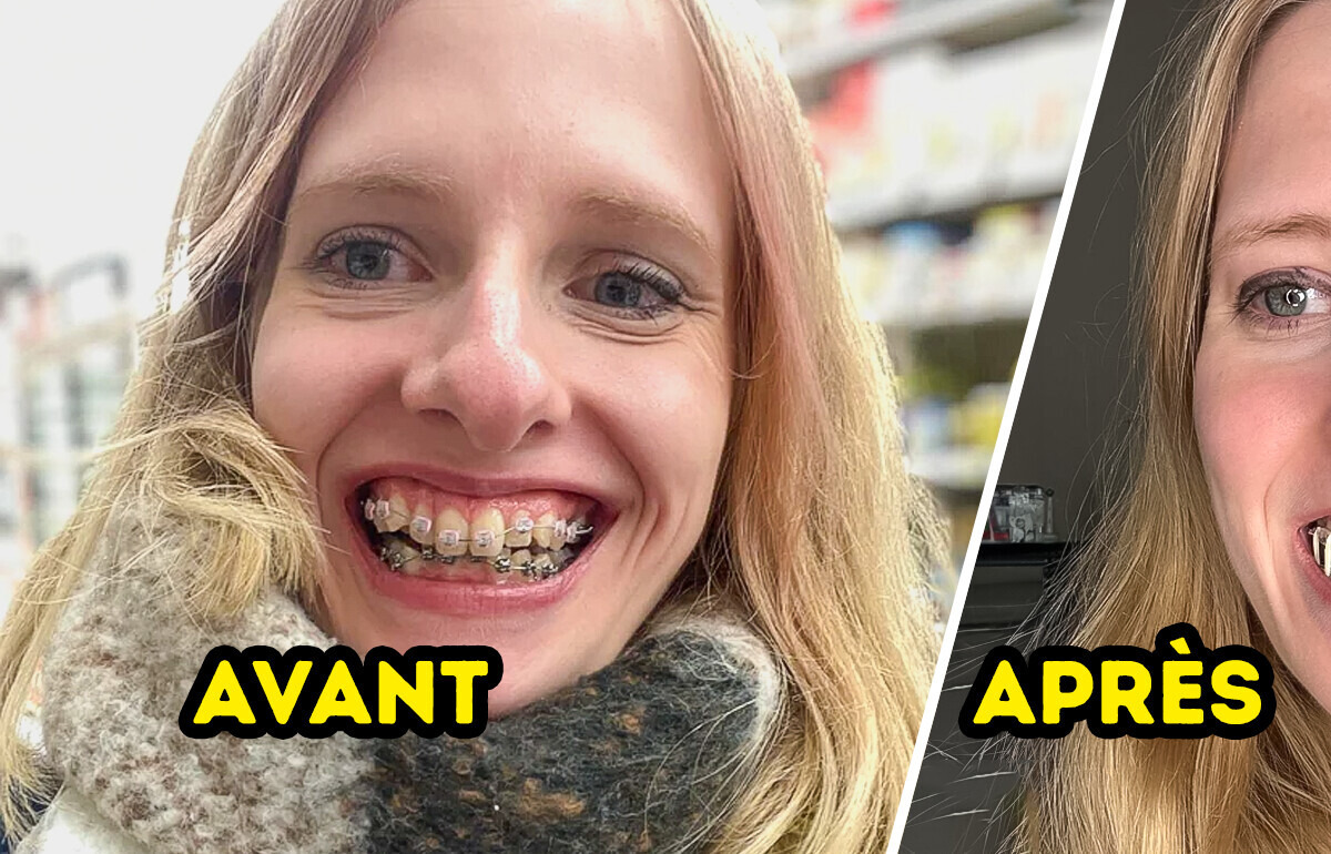 15 Histoires qui montrent à quel point un sourire soigné peut transformer une vie