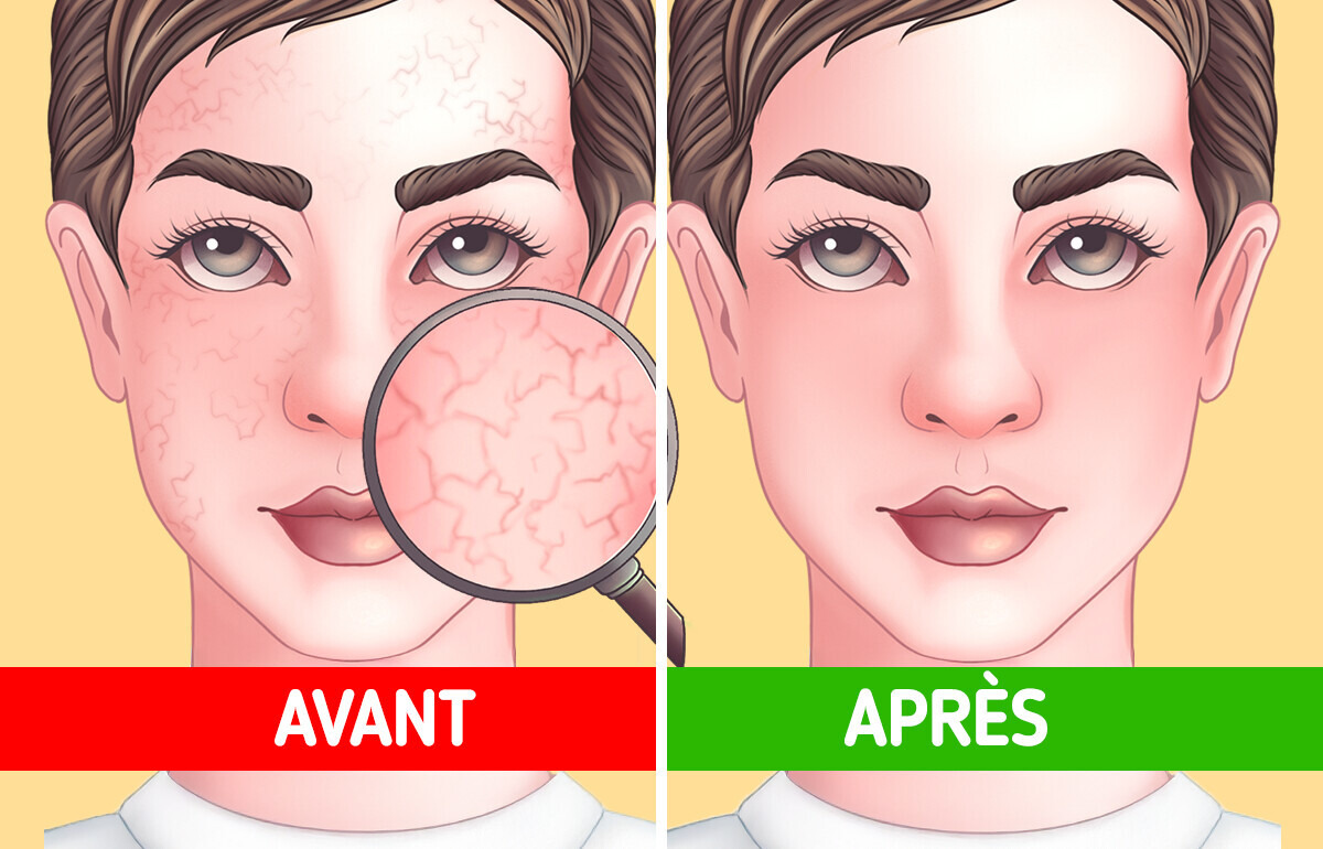 Voici ce qui se passe dans ton corps si tu bois des shots de curcuma tous les jours Voici ce qui se passe dans ton corps si tu bois des shots de curcuma tous les jours