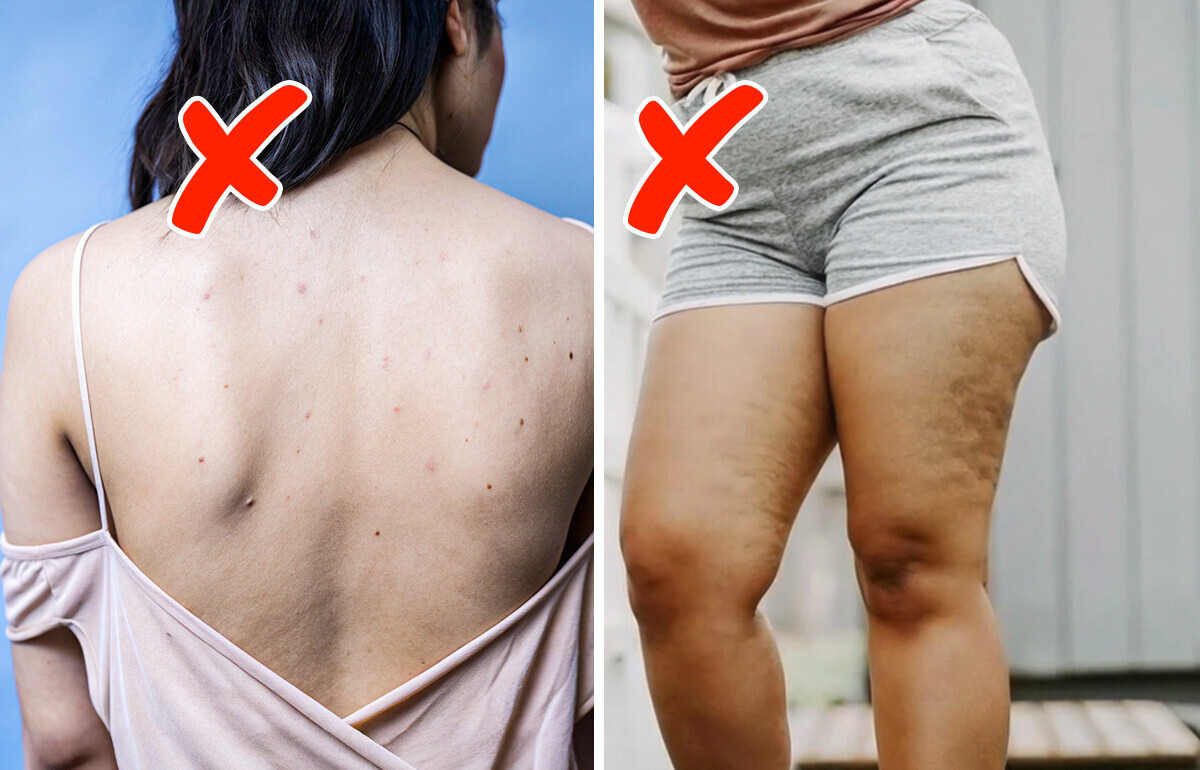 8 Conséquences surprenantes sur ta santé quand tu portes des vêtements trop serrés