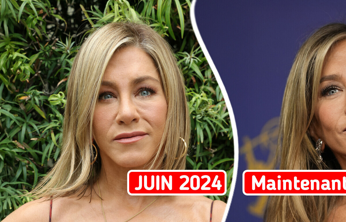 Jennifer Aniston choque avec sa transformation : elle abandonne les produits de comblement