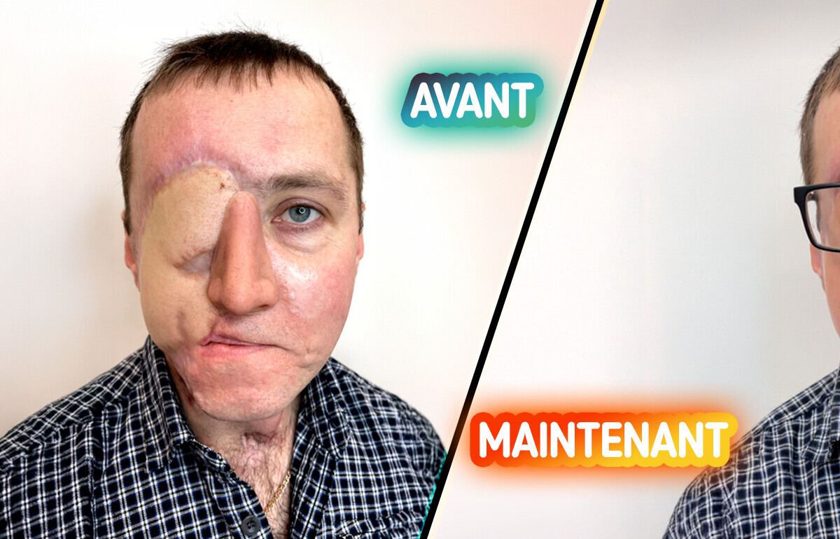Une tatoueuse redonne espoir et confiance à un homme défiguré suite à un accident bouleversant