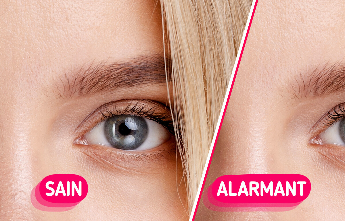 5 Signaux alarmants qui cachent peut-être de graves problèmes de santé 5 Signaux alarmants qui cachent peut-être de graves problèmes de santé