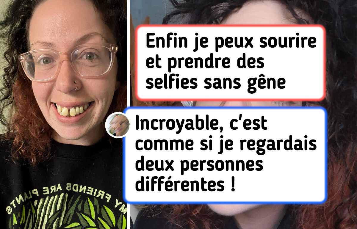 13 Photos qui révèlent des métamorphoses spectaculaires