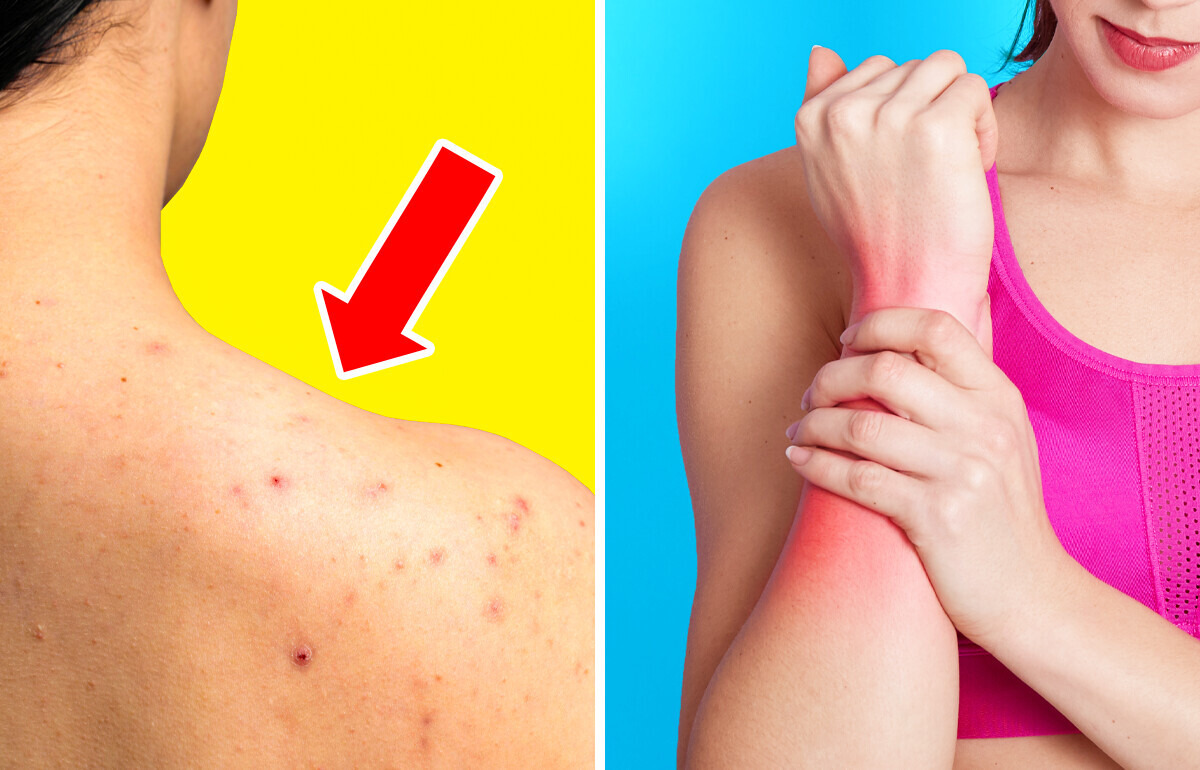 5 Façons alarmantes dont ton corps peut signaler des problèmes de santé 5 Façons alarmantes dont ton corps peut signaler des problèmes de santé