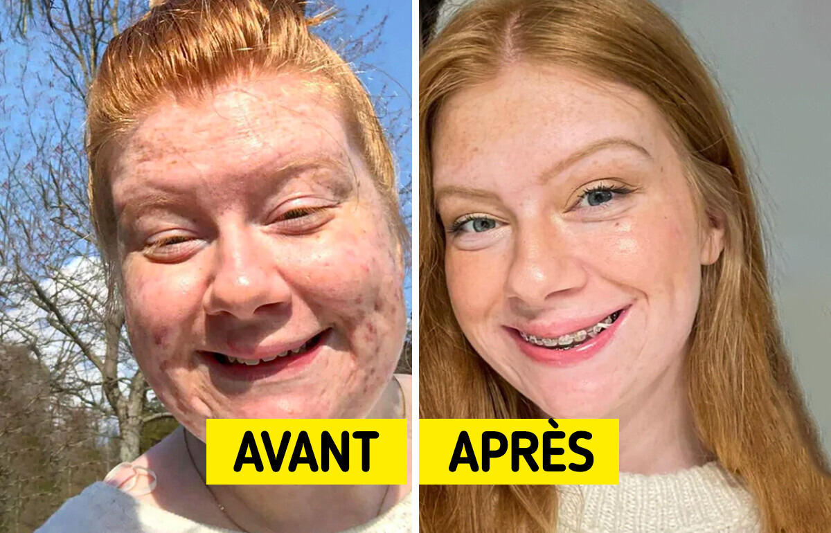 11 Personnes qui partagent fièrement leur transformation au fil des ans