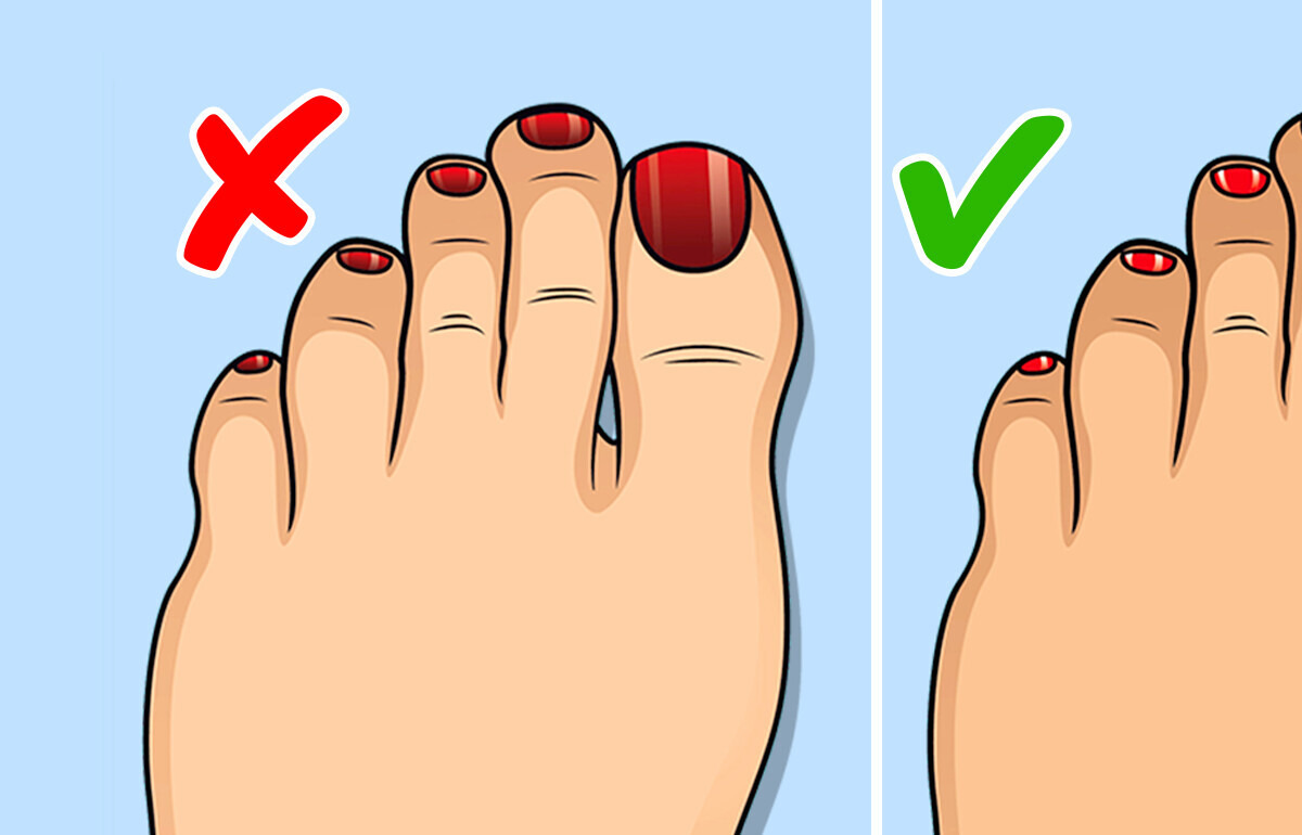 9 Signes discrets que tes pieds t’envoient sur ta santé