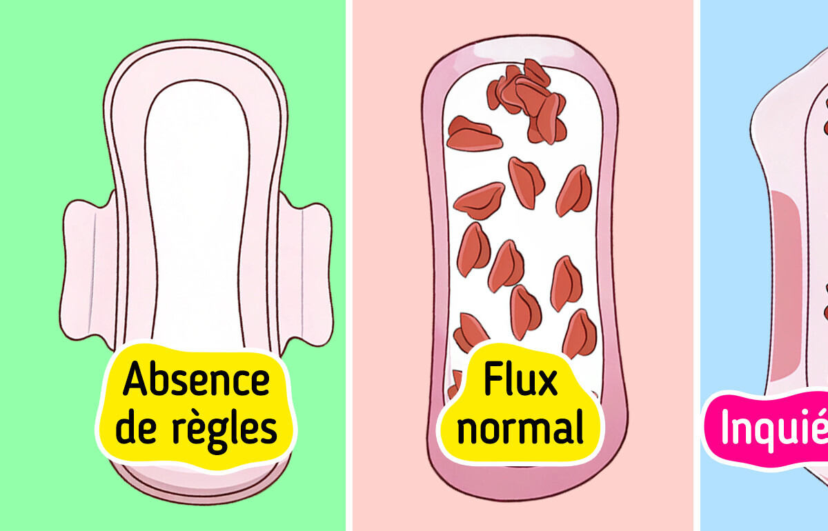 10 Signes qui peuvent indiquer que tu souffres d’endométriose (sans même le savoir)
