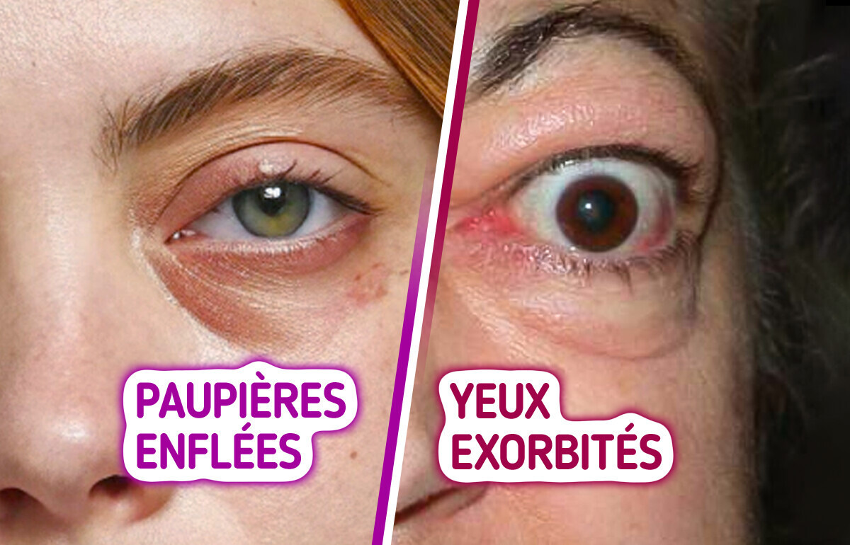 12 Signes étranges dans tes yeux qui pourraient cacher un souci de santé 12 Signes étranges dans tes yeux qui pourraient cacher un souci de santé