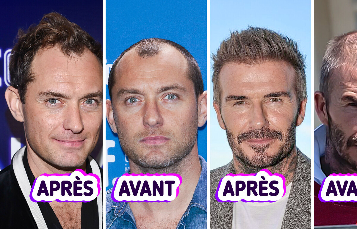 12 Hommes célèbres qui ont (peut-être) retrouvé leurs cheveux 12 Hommes célèbres qui ont (peut-être) retrouvé leurs cheveux