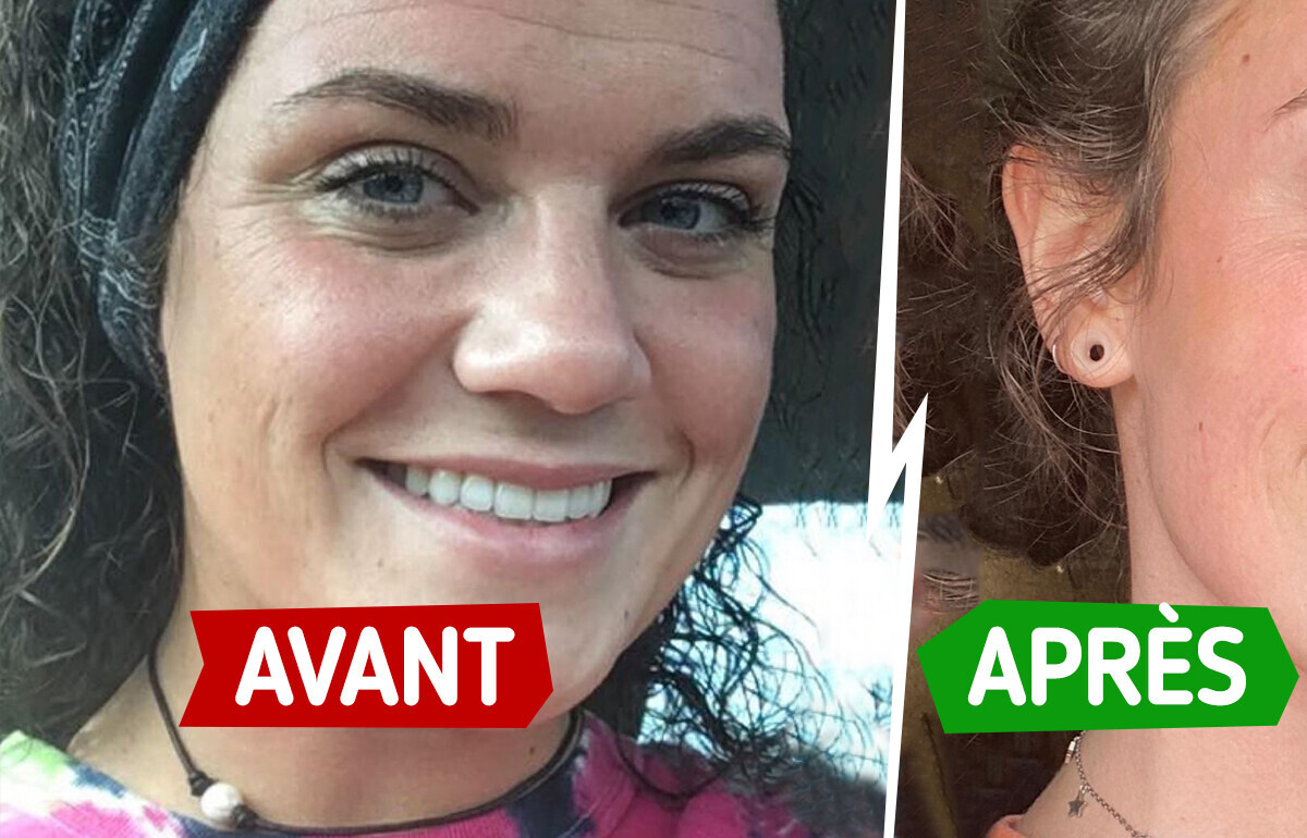 10 Personnes qui ont transformé leur peau en changeant simplement leur routine beauté 10 Personnes qui ont transformé leur peau en changeant simplement leur routine beauté
