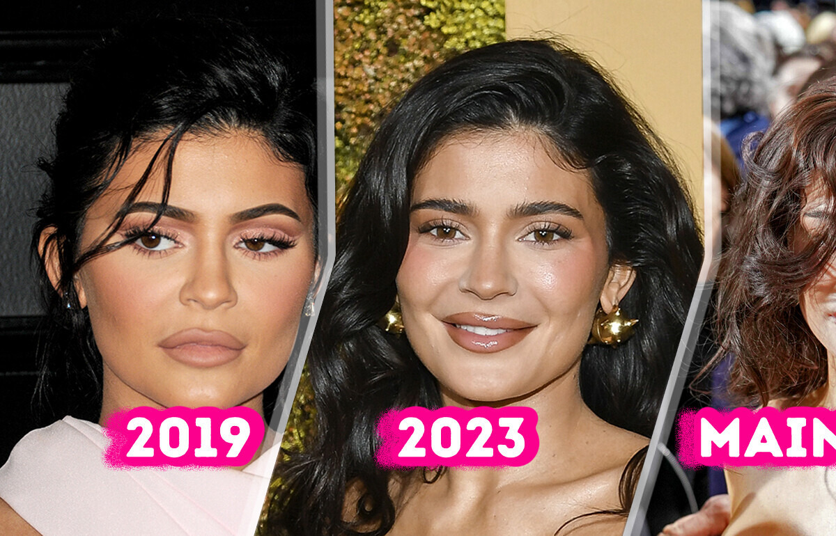 Kylie Jenner surprend ses fans avec un visage récemment transformé Kylie Jenner surprend ses fans avec un visage récemment transformé