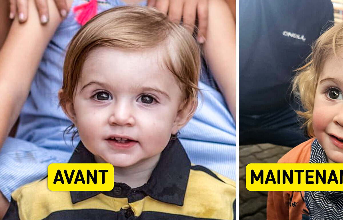 Cette maman met en garde alors qu'un adulte a embrassé son fils et il risque de perdre son œil
