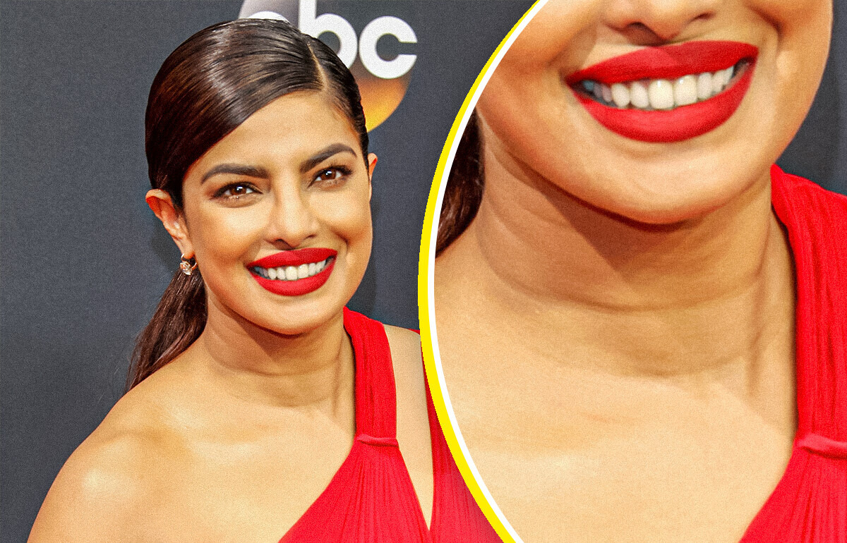 13 Célébrités qui prouvent qu’on peut briller avec des imperfections