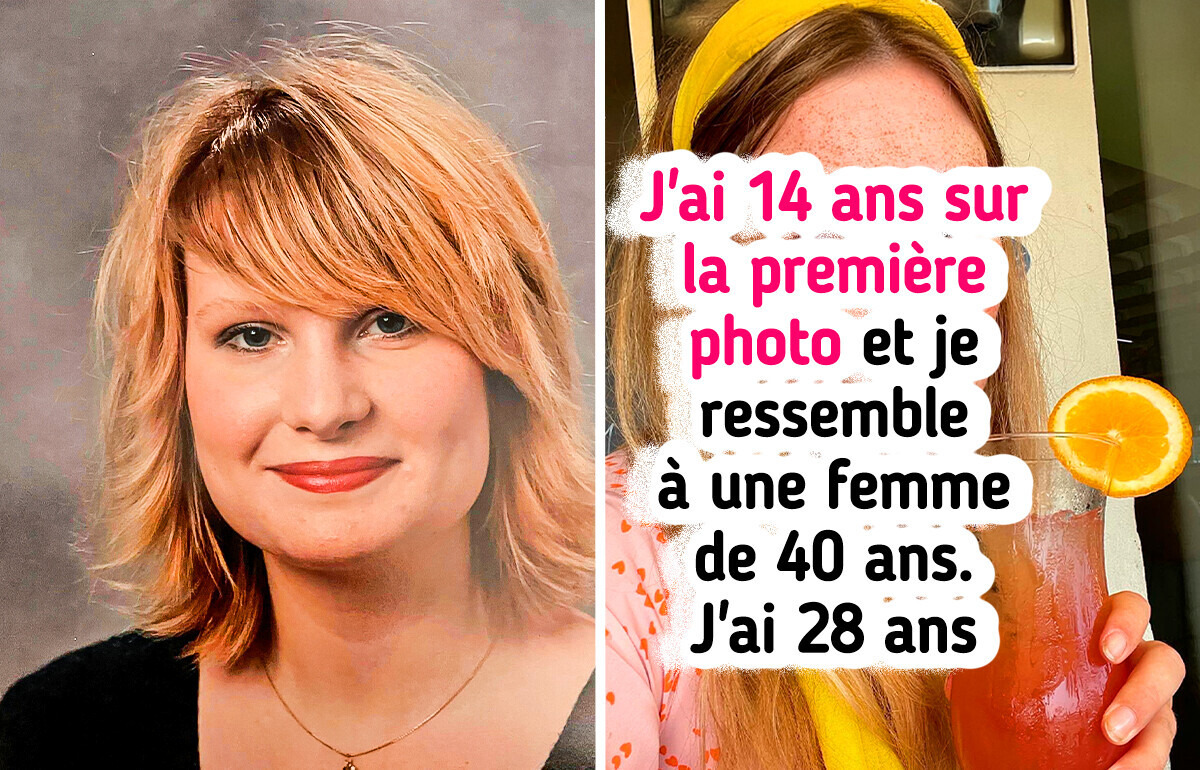 19 Personnes vraiment courageuses qui n’ont pas eu peur de montrer leurs photos d’enfance