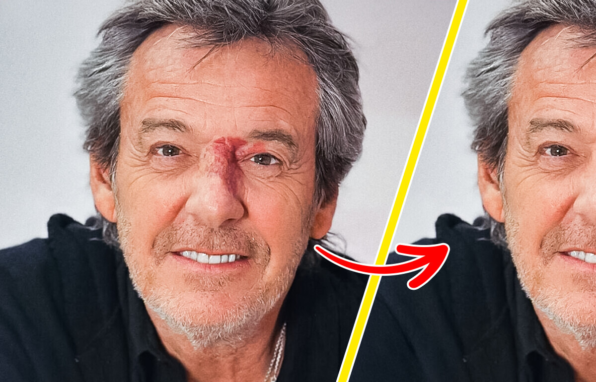 Voici à quoi ressembleraient ces 12 stars sans leur signe distinctif Voici à quoi ressembleraient ces 12 stars sans leur signe distinctif