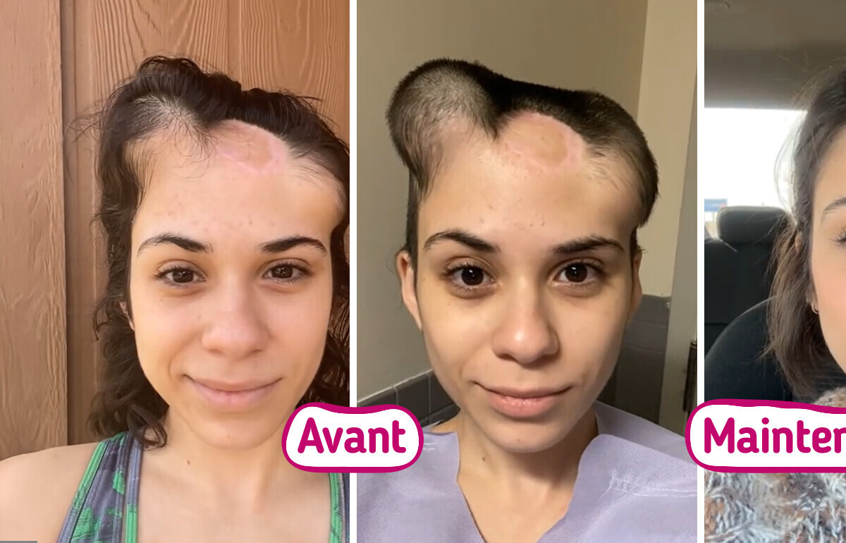 13 Personnes dont les transformations incroyables nous ont fait réfléchir à deux fois 13 Personnes dont les transformations incroyables nous ont fait réfléchir à deux fois