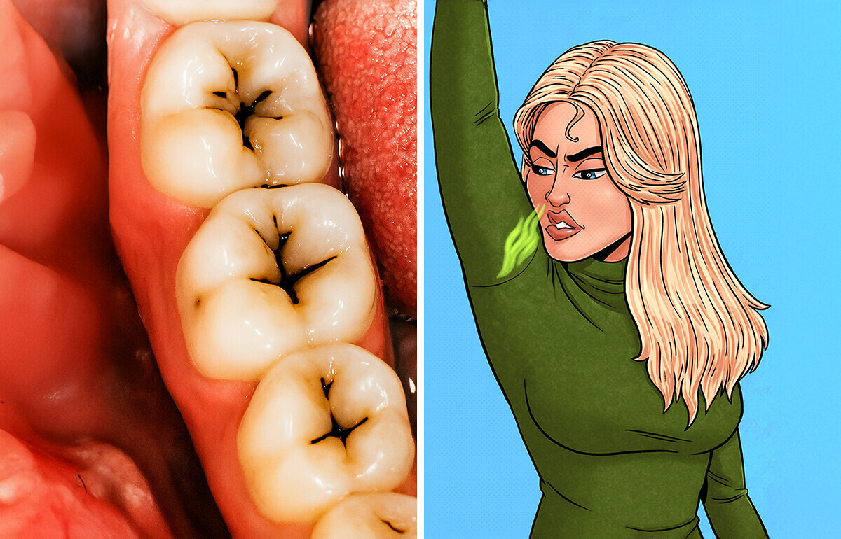 7 Signes sournois de la démence que tu pourrais ignorer 7 Signes sournois de la démence que tu pourrais ignorer