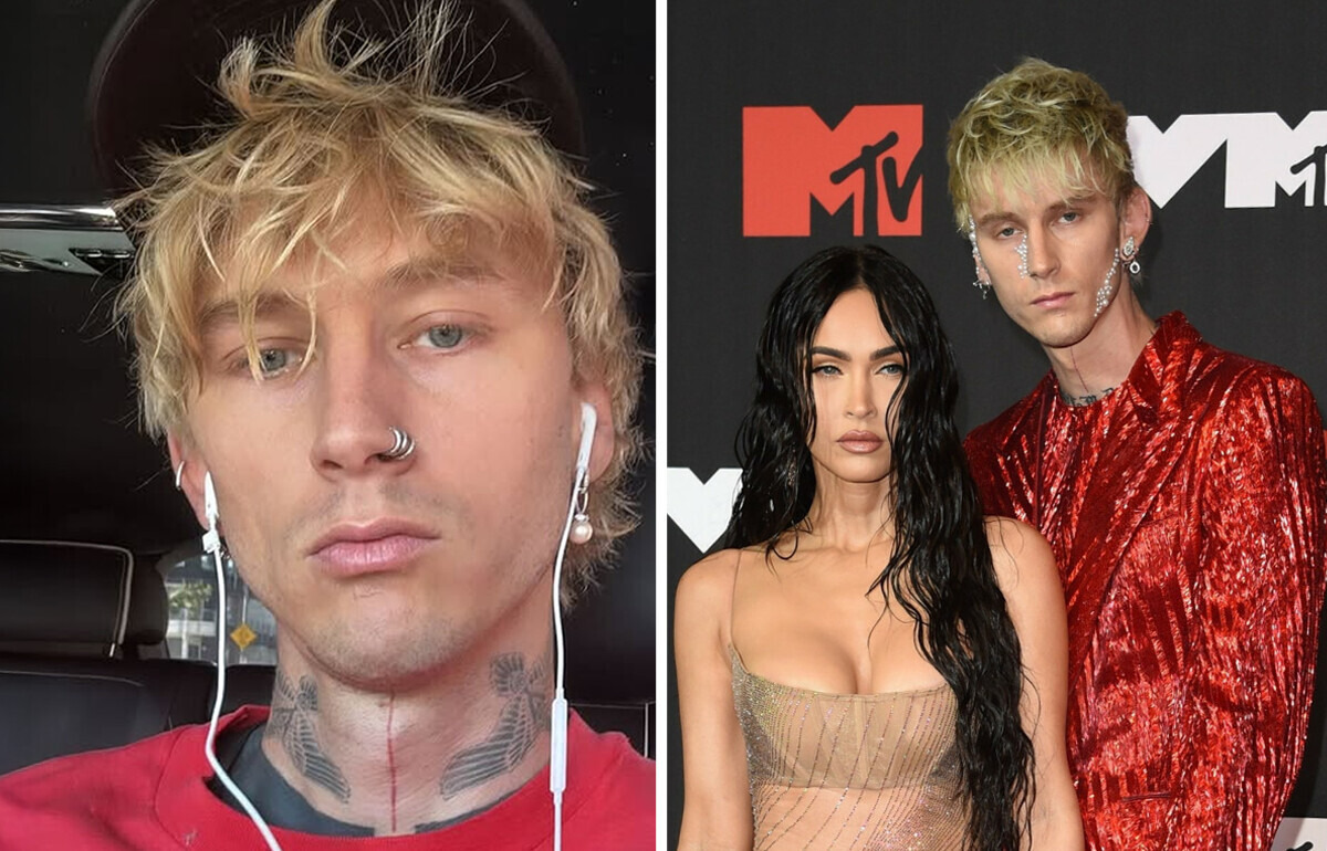 Machine Gun Kelly dit qu’il ne mange “que quelques fois par semaine” et partage ses problèmes de santé