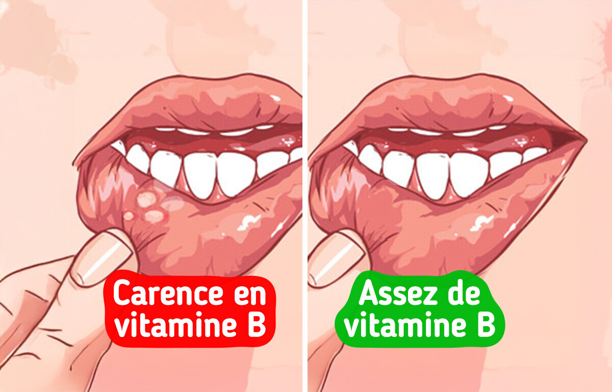 10 Signes d’alerte que ton corps pourrait manquer de nutriments essentiels 10 Signes d’alerte que ton corps pourrait manquer de nutriments essentiels