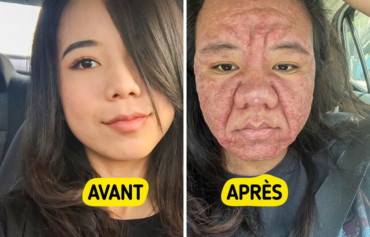 Cette femme dévoile sans filtre la réalité de la grossesse
