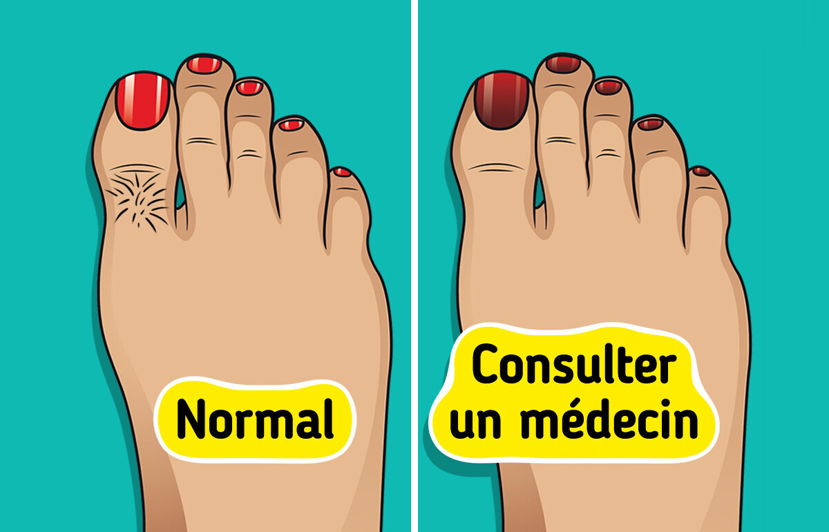 9 Choses que tes pieds peuvent révéler sur ta santé (et que tu ne devrais pas ignorer) 9 Choses que tes pieds peuvent révéler sur ta santé (et que tu ne devrais pas ignorer)