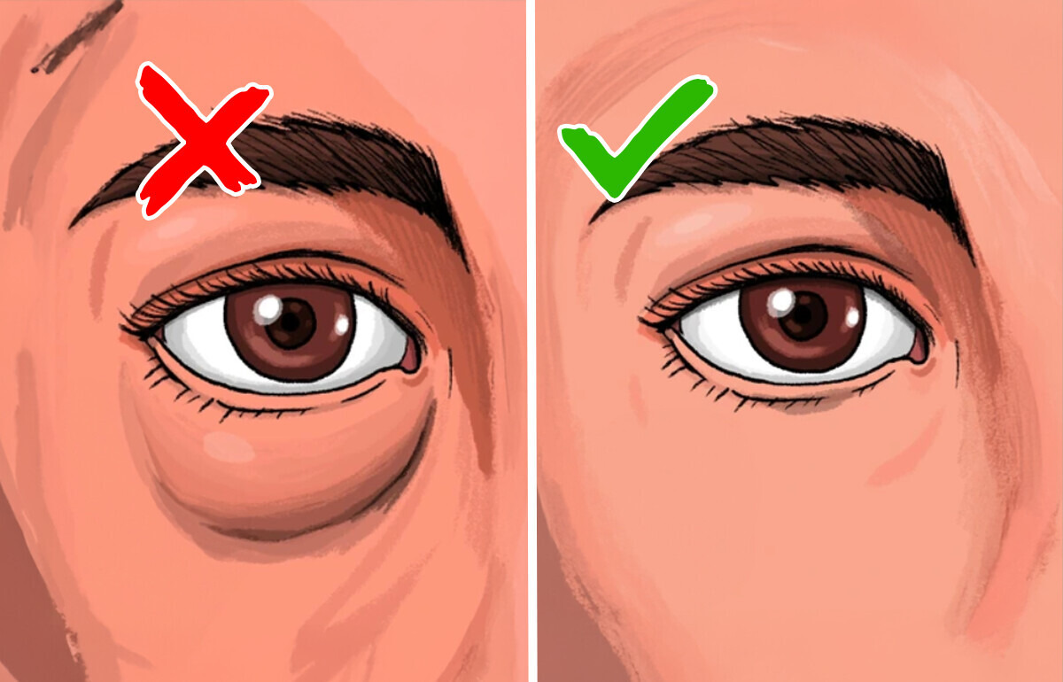 9 Signes qui montrent que tes reins peuvent être en danger 9 Signes qui montrent que tes reins peuvent être en danger