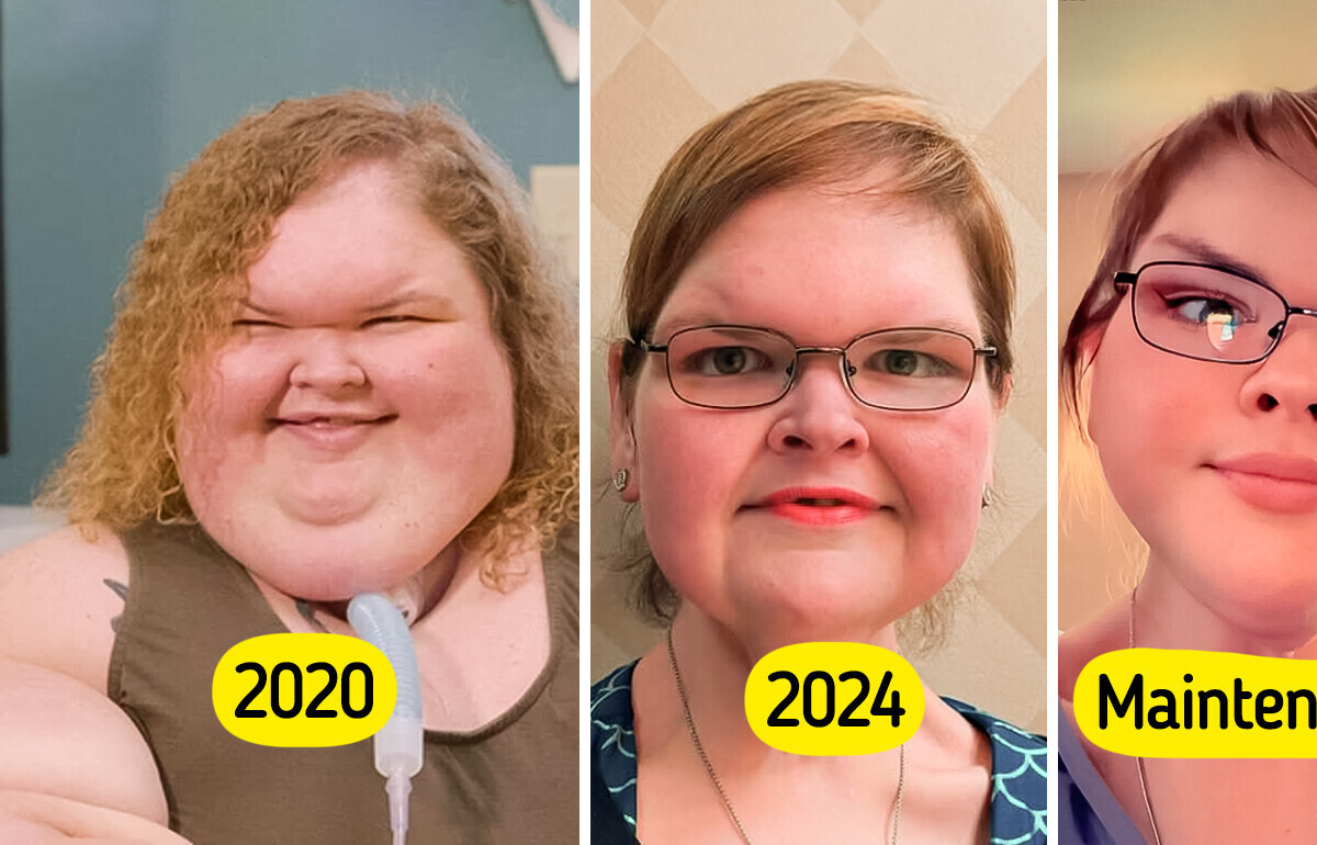 La star de “Sœurs de poids” fait sensation avec son nouveau look après une chirurgie de la peau La star de “Sœurs de poids” fait sensation avec son nouveau look après une chirurgie de la peau