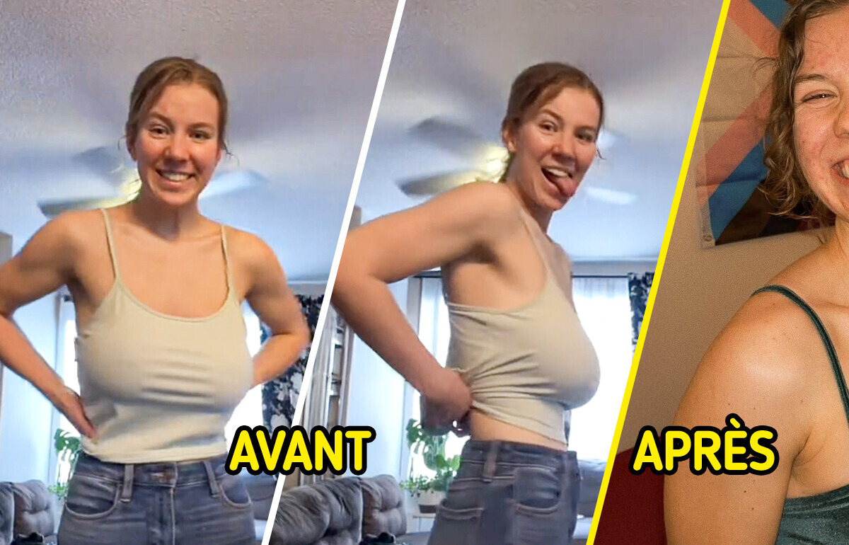 Une femme dévoile le résultat de sa réduction mammaire et fait le buzz sur la toile Une femme dévoile le résultat de sa réduction mammaire et fait le buzz sur la toile