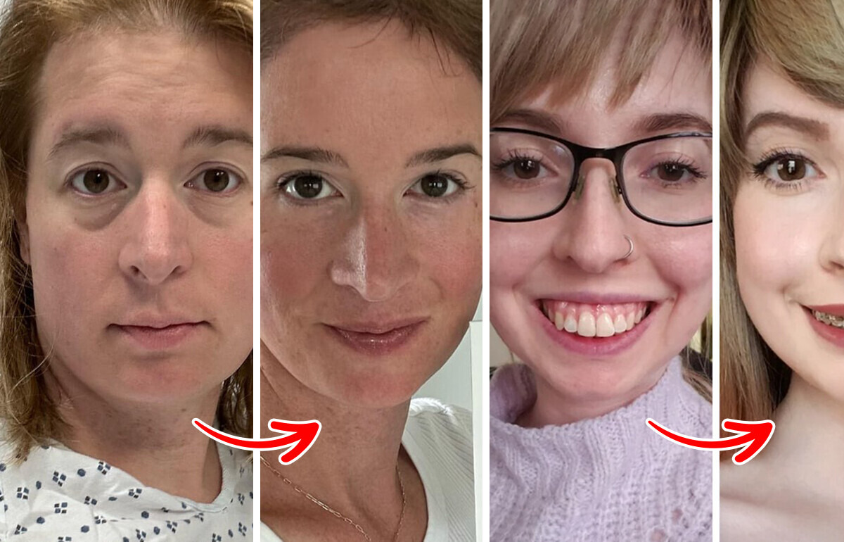 16 Femmes qui prouvent que même le plus petit changement peut avoir un grand impact