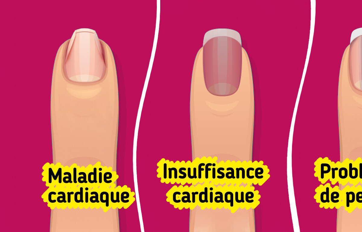 Ton corps pourrait être en détresse, et tes ongles de pieds sont les premiers à le montrer
