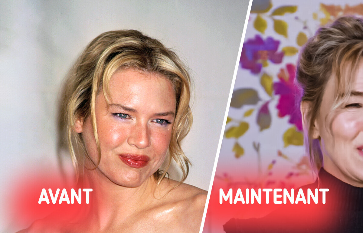 Renée Zellweger change radicalement d'apparence et surprend ses fans