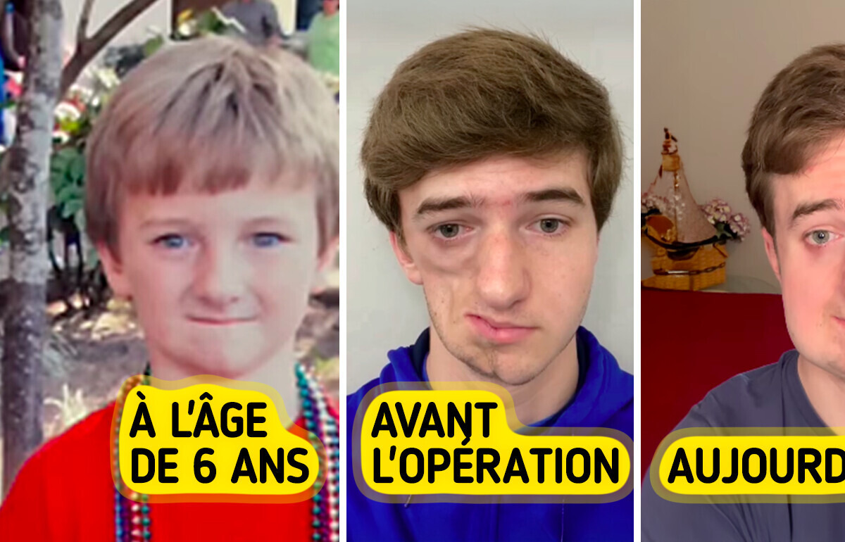 La maladie rare d’un jeune homme a fait de lui un héros inattendu en ligne La maladie rare d’un jeune homme a fait de lui un héros inattendu en ligne