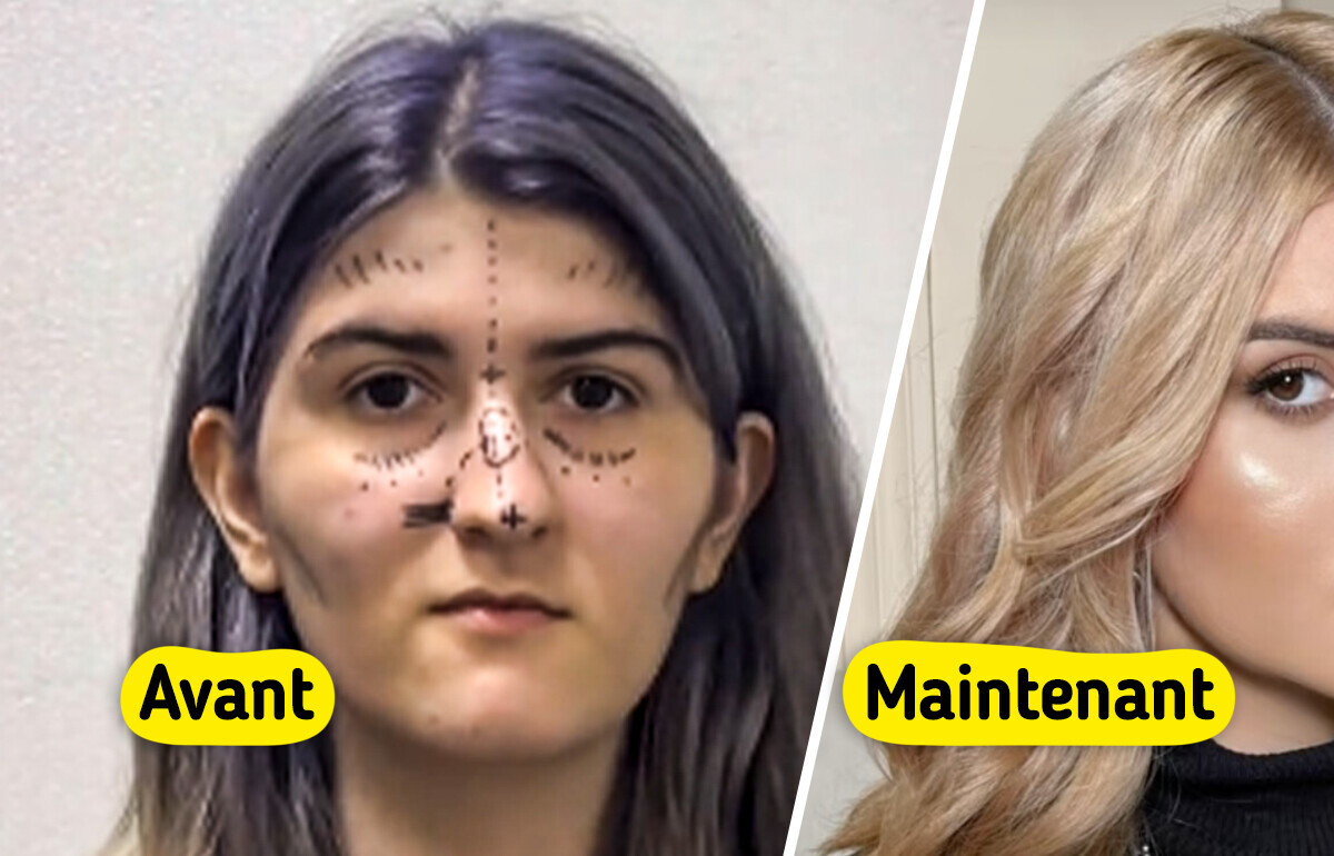 Elle subit une chirurgie complète en Corée du Sud et sa métamorphose enflamme la toile Elle subit une chirurgie complète en Corée du Sud et sa métamorphose enflamme la toile