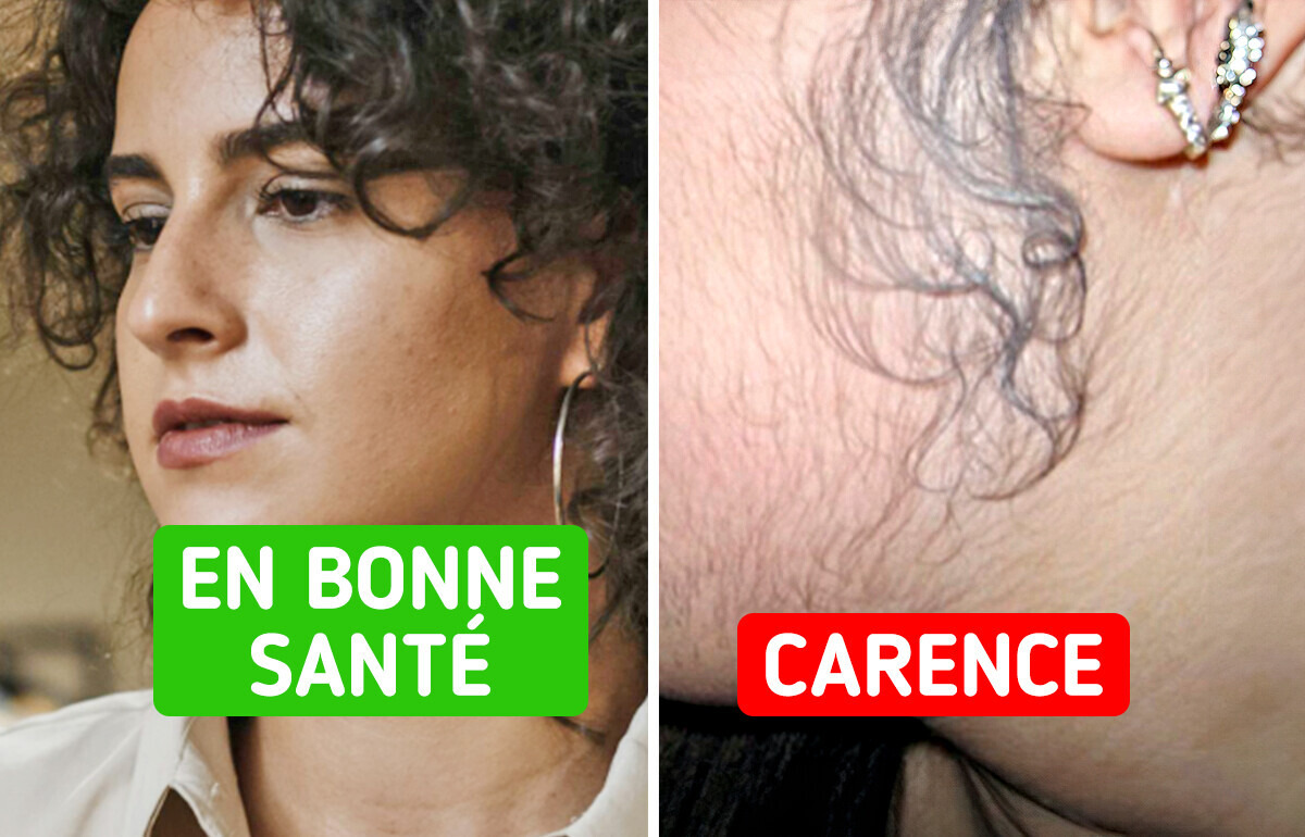 5 Choses que ton corps fait quand il manque de vitamine D 5 Choses que ton corps fait quand il manque de vitamine D