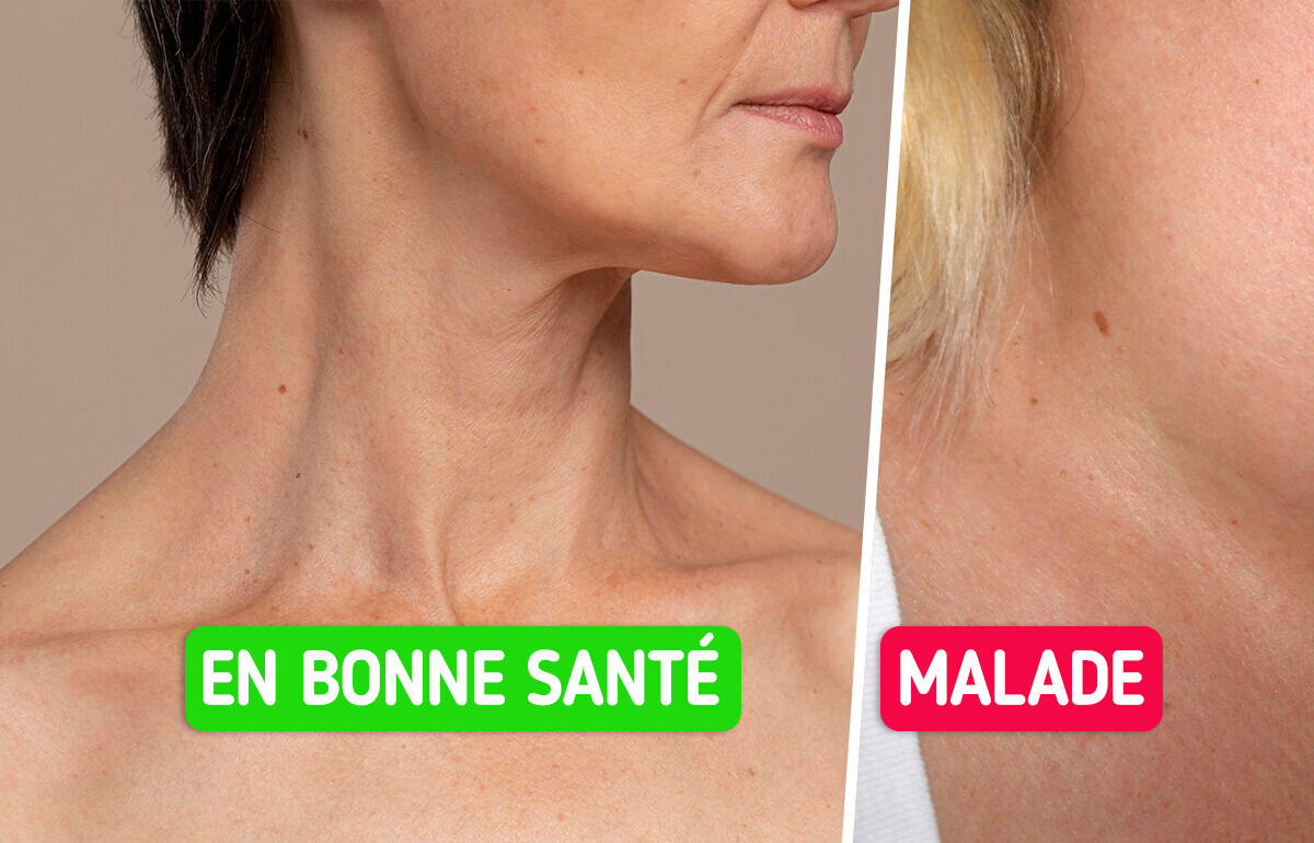 6 Signes d’alerte que ta thyroïde pourrait avoir des problèmes