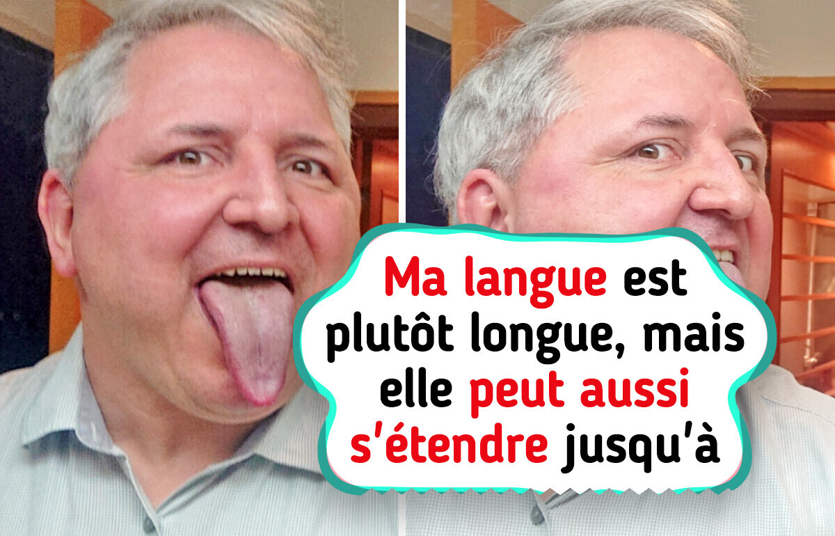 15 Caractéristiques inhabituelles du corps humain qui rendent leurs propriétaires uniques