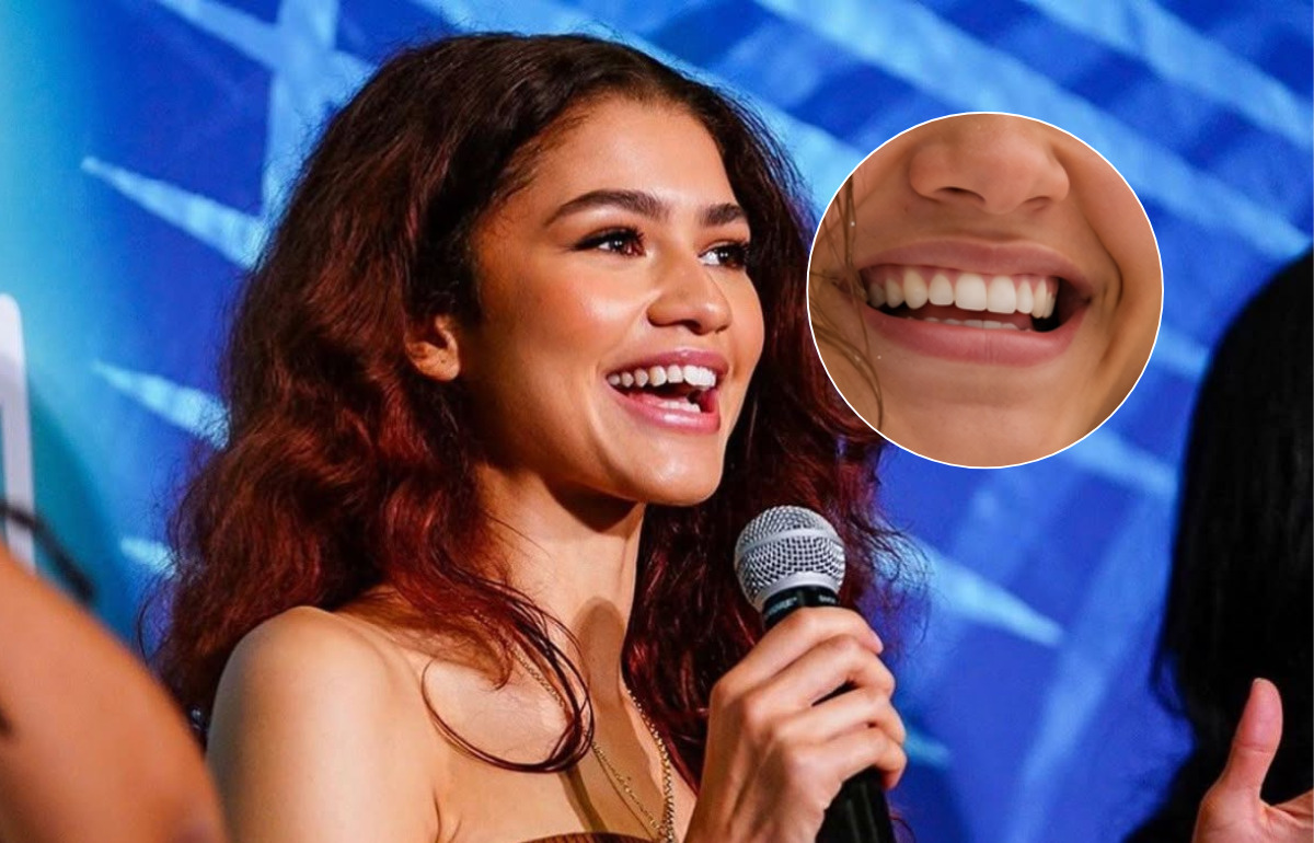 Pourquoi le sourire de Zendaya séduit autant à l’ère des facettes ultra-blanches Pourquoi le sourire de Zendaya séduit autant à l’ère des facettes ultra-blanches