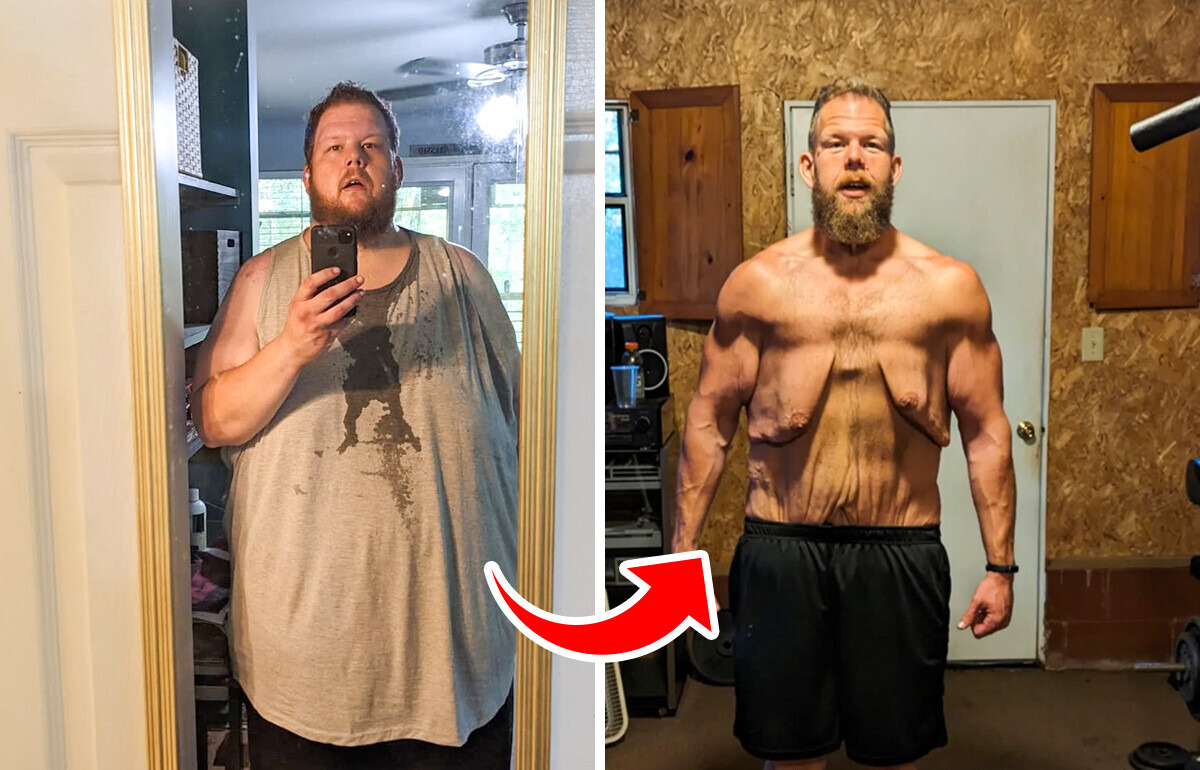 Il perd 160 kilos et son parcours inspire le monde entier Il perd 160 kilos et son parcours inspire le monde entier