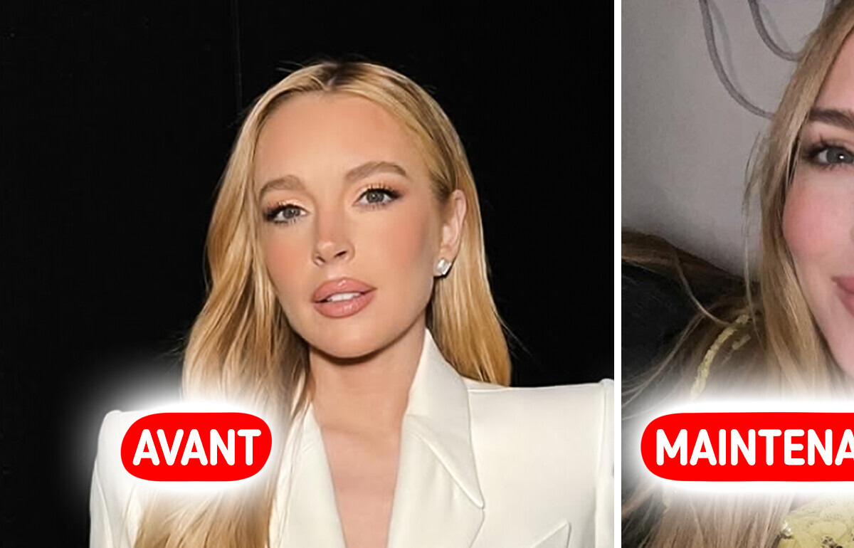 La dernière photo de Lindsay Lohan fait sensation et un détail relance les rumeurs de chirurgie esthétique La dernière photo de Lindsay Lohan fait sensation et un détail relance les rumeurs de chirurgie esthétique