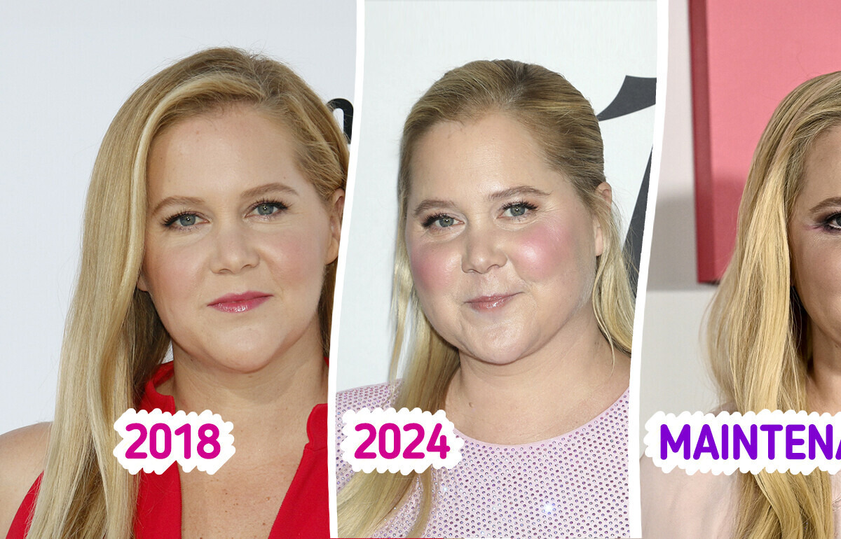 “Visage bouffi”, des internautes ont aidé Amy Schumer à découvrir le problème survenu après sa grossesse “Visage bouffi”, des internautes ont aidé Amy Schumer à découvrir le problème survenu après sa grossesse