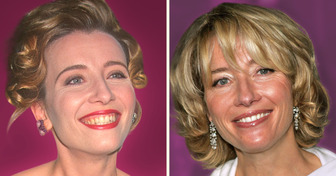 19 Stars qui ont changé leurs dents et éblouissent tout le monde avec leur sourire
