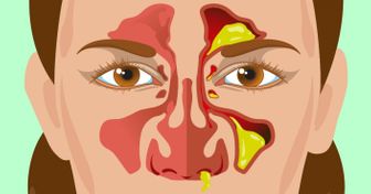 Découvre 9 choses que tes sécrétions nasales révèlent à propos de ta santé !