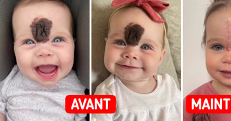 “On nous dévisageait”, cette famille a pris une décision difficile pour protéger leur fille des jugements