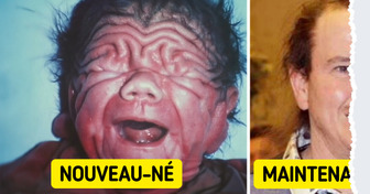 L’histoire du bébé qui a défié le destin