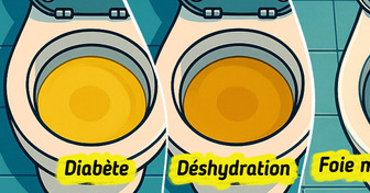 7 Signes inquiétants que ton urine peut révéler sur ta santé