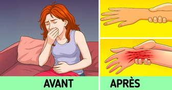 7 Signes alarmants d’AVC chez les femmes qui passent souvent inaperçus