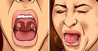 9 Choses qui peuvent te donner un mauvais goût dans la bouche