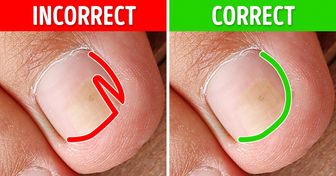 Découvre ces 9 manières efficaces pour soigner les ongles incarnés des orteils